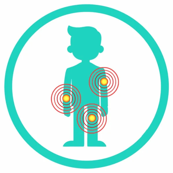 Specialist clinical icon for muscle strains and tears identifying the damaged muscle fibres and scar tissue as the primary target for focused shockwave treatment.